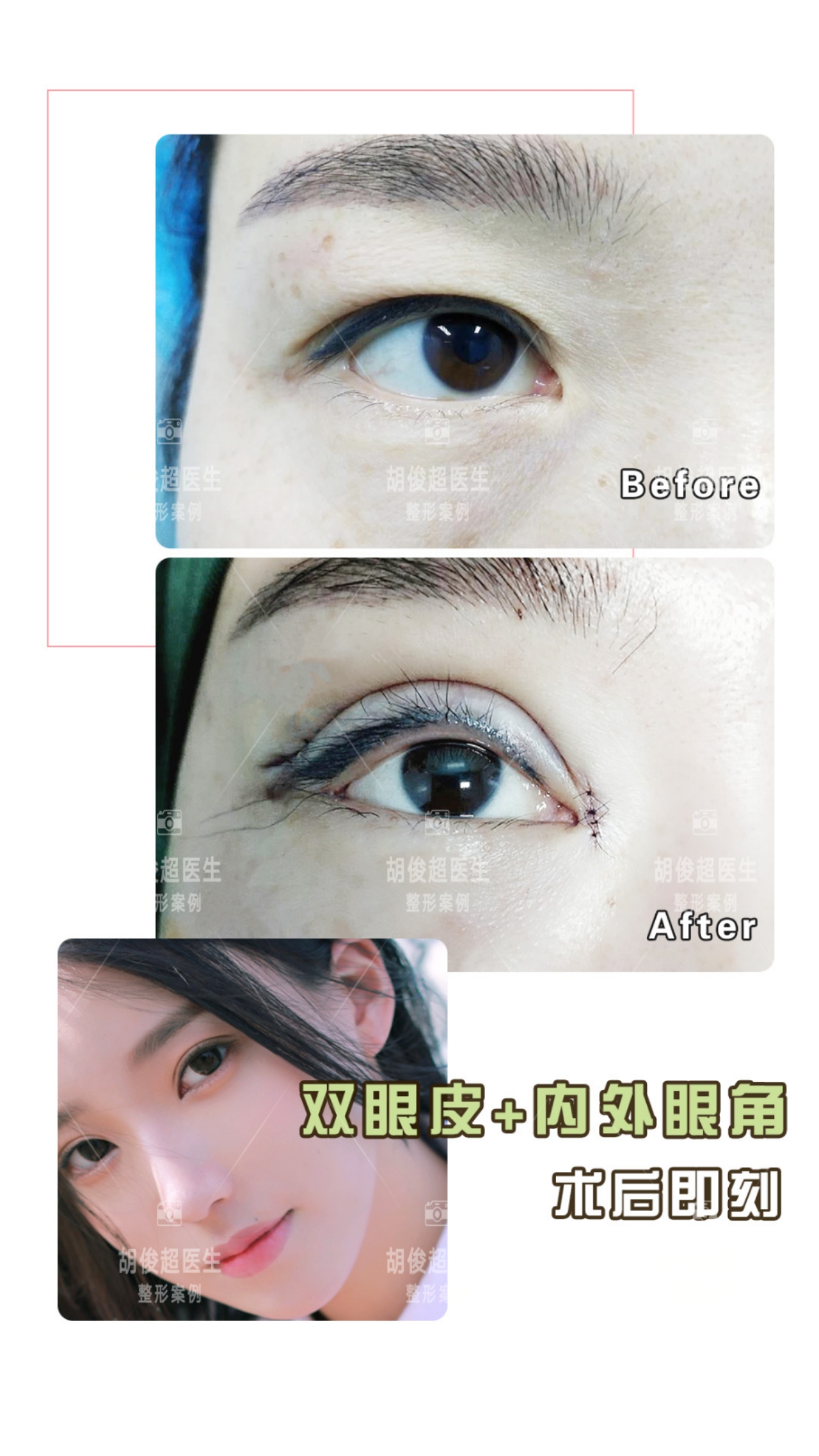 胡俊超